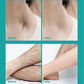 🔥 Crema depilatoria indolora para todo el cuerpo para hombres y mujeres – Amigable con la piel para todas las zonas 🌿